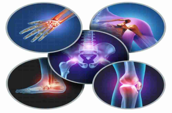 What You Should Know About Osteoarthritis (OA)